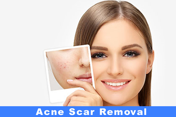 Laser Scar Removal